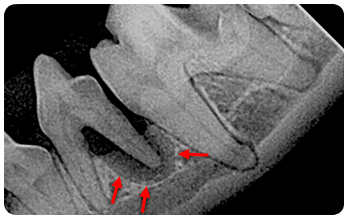 Standard Post with Image